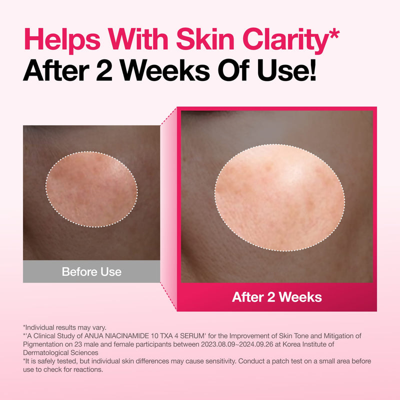 ANUA Niacinamide 10% + TXA 4% Serum - texture et packaging