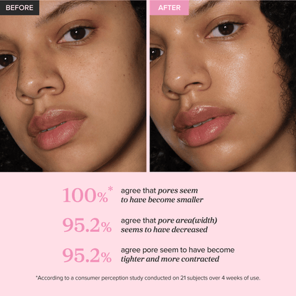 Avant / après Beauty of Joseon Pore Firming Serum, résultats de la marque